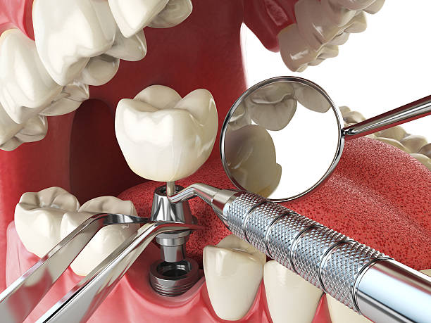 Best Broken or Cracked Tooth Emergency Dentist in Bainbridge, GA