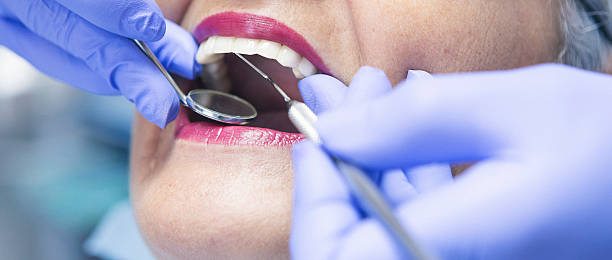 Best Emergency Dentist for Knocked-Out Tooth in Bainbridge, GA